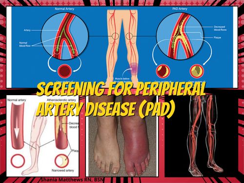 Book Creator | Screenings for Peripheral Artery Disease
